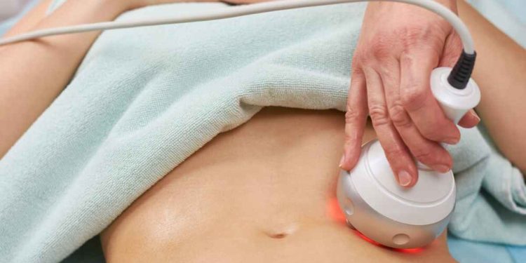 What is Hot Sculpting Body Contouring?